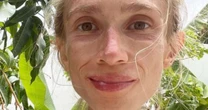Dançarina é encontrada morta em hotel com 22 kg após dieta extrema