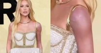 O que rolou? Marina Ruy Barbosa se justifica após aparecer com o braço roxo em evento