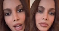 Sem 'pé na cova', sem cara 'desfigurada': Anitta fala pela 1ª vez sobre nova plástica no rosto. 'Eu sempre fiz, mas'