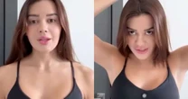 Franciny Ehlke revela perda de cabelo e desabafa: 'Eu tento me controlar...'