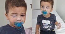 Bebê vai parar no hospital após grudar o próprio olho com Super Bonder em SC