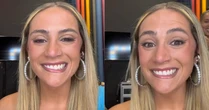 Luisa Perissé toma susto com paralisia facial durante gravação de programa: 'Não consigo fechar a boca'