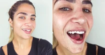 Jéssica Beatriz, filha de Leonardo, exibe novo sorriso após arrumar os dentes quebrados em tombo