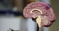 Mulher morre após aneurisma cerebral romper durante orgasmo