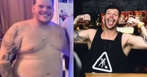 Cantor Ferrugem impressiona com antes e depois após perder 35 kg; veja