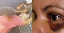 Vítima dos 61 socos relembra falas do agressor durante violência: 'Você vai morrer'