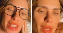 Carolina Dieckmann nega ter feito 'procedimentos louquíssimos' ao surgir com a boca inchada