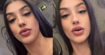 Bia Miranda surpreende ao mostrar ferimento após acidente: 'Tá ardendo muito'