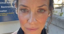 É grave? Atriz sofre acidente na praia e aparece com rosto machucado; veja