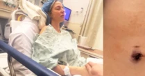 Participante de 'Casamento às Cegas' diagnosticada com câncer na gravidez quebra silêncio: 'Não tive sintomas'