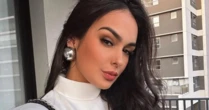 Ex-BBB Larissa Santos detalha sua recuperação após levar 14 pontos em acidente: 'Evoluindo'