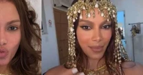 'Enganou todo mundo': Anitta reaparece com rosto mais natural após procedimentos estéticos e confunde fãs; compare o antes e depois