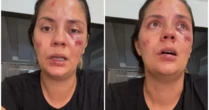 Mulher é arremessada de montanha-russa em parque aquático recém-inaugurado: 'Foi desesperador'
