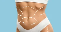 Tendências e tecnologia moldam o futuro da cirurgia plástica