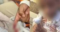 Menino de 6 anos é atacado por piranhas em rio na Bahia