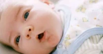 Seu bebê fica sempre com a cabecinha virada pro mesmo lado? Pode ser Torcicolo Congênito