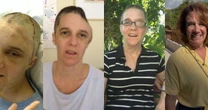 Antes e depois de Renee Murdoch: veja em 32 fotos como está hoje a pastora que ficou entre a vida e a morte após agressão e inspirou o filme 'Fé Para o Impossível'