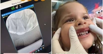 Maria Flor, filha de Virginia, coloca aparelho nos dentes com apenas 2 anos; saiba o motivo