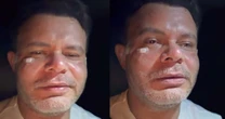Humorista Aluísio Júnior diz que foi agredido com a mulher e o filho após jogo entre Fortaleza e Vasco