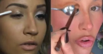 Antes e depois: Bianca Andrade mostra as mudanças no rosto após procedimentos estéticos