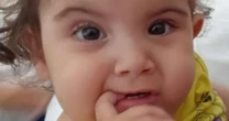 Morre uma das siamesas que passaram por cirurgia de separação em Goiás