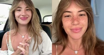 Tendência ou polêmica? Influenciadora tatua sardas no rosto e viraliza nas redes sociais