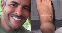 Lesão grave! Marido de Simone Mendes detalha entorse no tornozelo e mostra sofrimento em vídeo