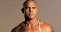 O que rolou? Vitor Belfort surge com rosto inchaço e deixa fãs assustados