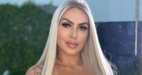 Imagens fortes! Grávida, Juju Ferrari expõe complicações graves causadas por hidrogel