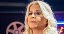 Há 15 anos, Paula Toller, do Kid Abelha, diminuiu açúcar e fazia contagem de carboidrato diariamente em dieta ao descobrir doença incurável