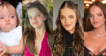 Antes e depois de Rafa Justus em 50 fotos: da infância à rinoplastia e ortognática, filha de Ticiane Pinheiro e Roberto Justus mudou MUITO e vai te impressionar