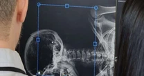 Tecnologia revela o invisível: IGP adota scanners cadavéricos no RS