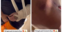 Cantor baleado na Barra Funda agradece apoio após alta e exibe ferimentos: 'À queima-roupa'