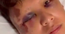 Turista mexicano é agredido com garrafada na cabeça em Copacabana