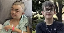 BRUTAL! Após fazer piada, garoto de 14 anos é espancado na escola e perde parte do crânio
