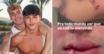 Mãe do influenciador Luan Alencar diz que filho foi agredido pelo namorado: 'Desmaiou'
