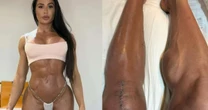 Gracyanne Barbosa mostra o corpo após lesão e cirurgia no Dança dos Famosos