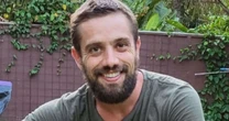 Ficou bom? Rafael Cardoso reaparece com novo visual e harmonização