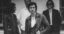 Alex Turner, do Arctic Monkeys, surpreende fãs com aparência em clique com brasileira; veja foto