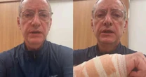 Burnier é atacado por pitbull sem guia em São Paulo; caso pode gerar indenização e responsabilização criminal