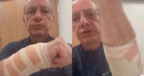 Jornalista da Globo fica gravemente ferido após ataque de pitbull; veja como ele está