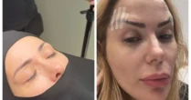 Influenciadora faz sua 50ª cirurgia plástica: 'É uma cirurgia delicada'