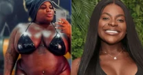 Com 69kg a menos, Jojo Todynho revela o antes e o depois real de sua cirurgia bariátrica
