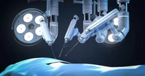 Cirurgia robótica facilita tratamentos urológicos