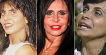 Antes e depois: 5 famosos que fizeram cirurgia plástica e mudaram drasticamente