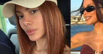 'Irreconhecível': Anitta abre álbum de fotos com selfies e nova aparência após procedimento estético volta a viralizar nos comentários