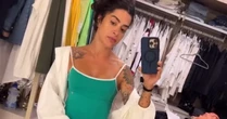 Aline Campos mostra resultado após remover tatuagem da perna: 'Era grande e feia'