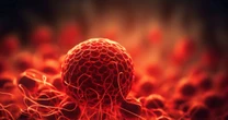 Car-T Cell é esperança para pacientes com mieloma múltiplo