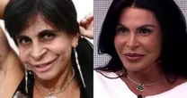 Gretchen detona quem fala sobre sua aparência