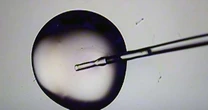 Erro em fertilização faz mulher dar à luz a bebê de outra pessoa na Austrália